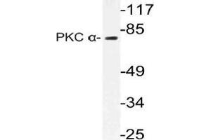 Western blot (WB) analysis of PKC alpha antibody in extracts from Jurkat cells. (PKC alpha Antikörper)