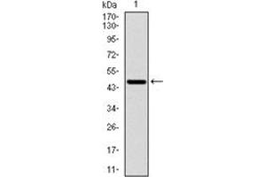 Western Blotting (WB) image for anti-Ribosomal Protein S6 Kinase, 70kDa, Polypeptide 1 (RPS6KB1) antibody (ABIN1108904) (RPS6KB1 Antikörper)