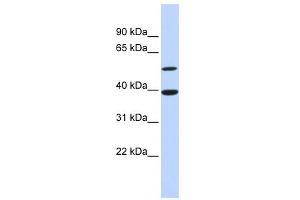 WB Suggested Anti-ATF7 Antibody Titration:  0. (AFT7 Antikörper  (N-Term))