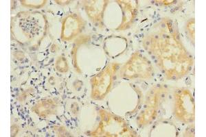 Immunohistochemistry of paraffin-embedded human kidney tissue using ABIN7145852 at dilution of 1:100