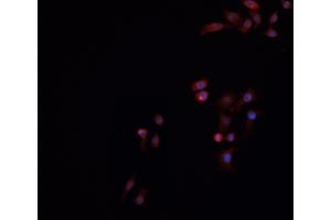 ABIN6269016 staining HeLa cells by IF/ICC. (Ku70/80 Antikörper)