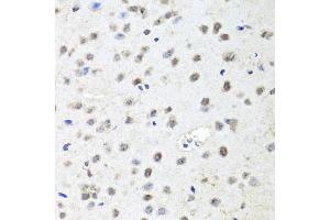 Immunohistochemistry of paraffin-embedded mouse brain using AGO2 antibody (ABIN5974124) at dilution of 1/100 (40x lens). (AGO2 Antikörper)