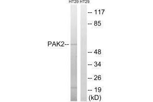 Western blot analysis of extracts from HT-29 cells, using PAK2 (Ab-197) antibody. (PAK2 Antikörper  (Ser62))