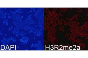 Immunofluorescence analysis of 293T cell using H3R2me2a antibody. (Histone 3 Antikörper  (H3R2me2a))