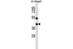 Western Blotting (WB) image for anti-Deltex Homolog 3 (Drosophila) (DTX3) antibody (ABIN2997344) (Deltex Homolog 3 Antikörper)