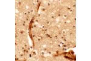 Immunohistochemistry of KCNK13 in human brain tissue with KCNK13 antibody at 5 ug/mL. (KCNK13 Antikörper  (Middle Region))