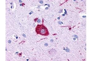 Immunohistochemical staining of Brain (Neuron) using anti- GPR116 antibody ABIN122116 (G Protein-Coupled Receptor 116 Antikörper  (Cytoplasmic Domain))