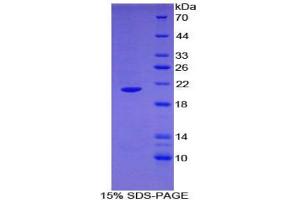 SDS-PAGE analysis of Human ARPC4 Protein.