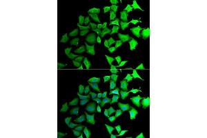 Immunofluorescence analysis of HeLa cells using TALDO1 antibody. (TALDO1 Antikörper  (AA 1-337))