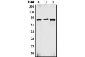Western blot analysis of gp91 phox expression in HepG2 (A), Caco2 (B), MCF7 (C) whole cell lysates.