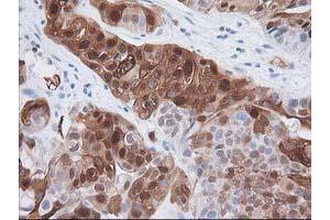 Image no. 3 for anti-Hydroxyprostaglandin Dehydrogenase 15-(NAD) (HPGD) antibody (ABIN1496363) (HPGD Antikörper)