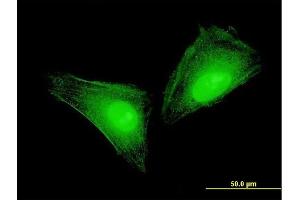 Immunofluorescence of monoclonal antibody to S100A11 on HeLa cell. (S100A11 Antikörper  (AA 1-105))