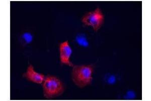 Vimentin antibody used at a dilution of 1:400 to detect COS7 cells. (Vimentin Antikörper  (N-Term))