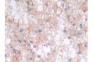 Immunohistochemistry (IHC) image for anti-Leukemia Inhibitory Factor (LIF) (AA 2-201) antibody (ABIN7430882)