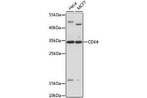 Western blot analysis of extracts of various cell lines, using CDK4 antibody. (CDK4 Antikörper  (AA 1-303))