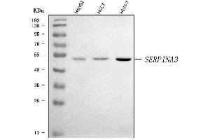Western blot analysis of AACT/SERPINA3 using anti-AACT/SERPINA3 antibody (ABIN7600832).