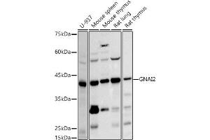 Western blot analysis of extracts of various cell lines, using GN antibody  at 1:500 dilution.
