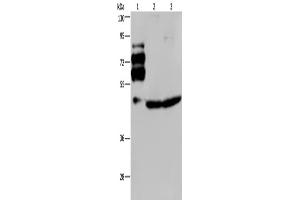 Western Blotting (WB) image for anti-Proprotein Convertase Subtilisin/kexin Type 9 (PCSK9) antibody (ABIN2433553) (PCSK9 Antikörper)