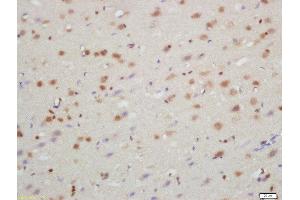 Formalin-fixed and paraffin embedded rat brain labeled with Rabbit Anti-TXNIP Polyclonal Antibody, Unconjugated  at 1:200 followed by conjugation to the secondary antibody and DAB staining