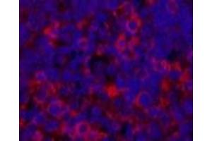 Immunofluorescence analysis of Rat spleen tissue using ERBB2 Monoclonal Antibody at dilution of 1:200. (ErbB2/Her2 Antikörper)