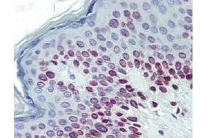 IHC Image for AP22639PU-N Human Skin (formalin-fixed, paraffin-embedded) stained with Lamin Cat 1/50 followed by biotinylated goat anti-rabbit IgG secondary antibody LS-D1, alkaline phosphatase-streptavidin and chromogen. (Lamin A/C Antikörper  (N-Term))