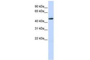Image no. 1 for anti-TEA Domain Family Member 2 (TEAD2) (N-Term) antibody (ABIN6740543) (TEAD2 Antikörper  (N-Term))