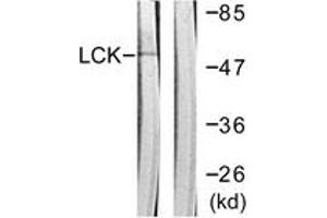 Western Blotting (WB) image for anti-Lymphocyte-Specific Protein tyrosine Kinase (LCK) (AA 161-210) antibody (ABIN2888674) (LCK Antikörper  (AA 161-210))