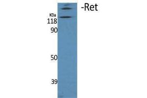 Western Blotting (WB) image for anti-Ret Proto-Oncogene (RET) (Thr77) antibody (ABIN3180294) (Ret Proto-Oncogene Antikörper  (Thr77))