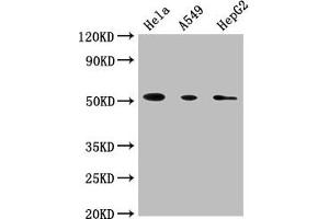 Western Blot Positive WB detected in: Hela whole cell lysate, A549 whole cell lysate, HepG2 whole cell lysate All lanes: CD14 antibody at 1:1800 Secondary Goat polyclonal to Mouse IgG at 1/10000 dilution Predicted band size: 41 kDa Observed band size: 55 kDa (CD14 Antikörper  (AA 20-345))