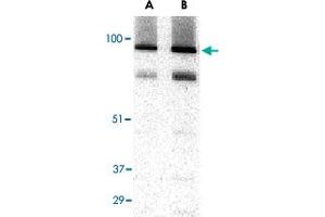 Western blot analysis of TRPC3 in human brain tissue lysate with TRPC3 polyclonal antibody  at (A) 1 and (B) 2 ug/mL . (TRPC3 Antikörper  (C-Term))
