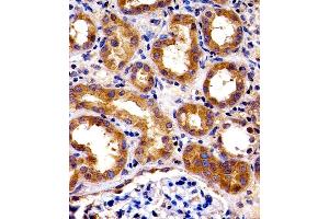 Immunohistochemical analysis of paraffin-embedded H. (SPHK1 Antikörper  (N-Term))