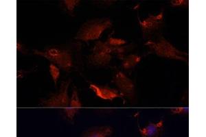 Immunofluorescence analysis of C6 cells using TYMS Polyclonal Antibody at dilution of 1:100. (TYMS Antikörper)