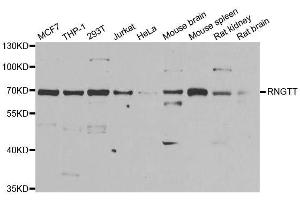 Western blot analysis of extracts of various cell lines, using RNGTT antibody. (RNGTT Antikörper  (AA 1-260))