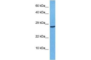 Host:  Rabbit  Target Name:  APOBEC3F  Sample Tissue:  Human 293T Whole Cell  Antibody Dilution:  1ug/ml (APOBEC3F Antikörper  (N-Term))