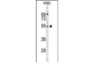 Western blot analysis of RPS6KB2 Antibody in K562 cell line lysates (35ug/lane) (RPS6KB2 Antikörper)