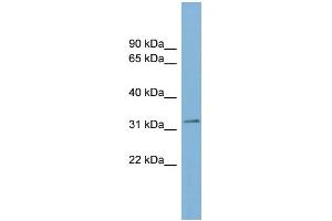 WB Suggested Anti-TMEM163 Antibody Titration:  0. (TMEM163 Antikörper  (Middle Region))