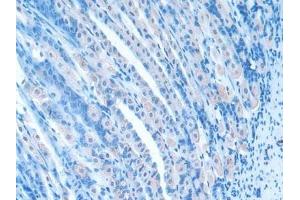 Immunohistochemistry (IHC) image for anti-R-Spondin 1 (RSPO1) (AA 21-135) antibody (ABIN7430147)