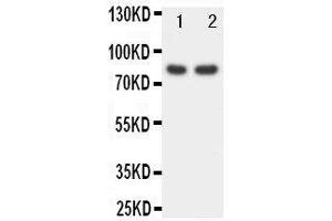 Anti-FOXP1 antibody, Western blotting Lane 1: Rat Spleen Tissue Lysate Lane 2: COLO320 Cell Lysate (FOXP1 Antikörper  (C-Term))