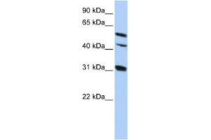 WB Suggested Anti-GJA8 Antibody Titration:  0. (GJA8 Antikörper  (Middle Region))