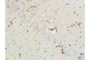 Formalin-fixed and paraffin embedded rat brain labeled with Rabbit Anti EphA7/Eph receptor A7 Polyclonal Antibody, Unconjugated  at 1:200 followed by conjugation to the secondary antibody and DAB staining
