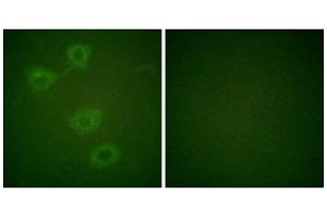 Immunofluorescence analysis of HuvEc cells, using Tyrosine Hydroxylase (Phospho-Ser19) antibody. (Tyrosine Hydroxylase Antikörper  (pSer19))