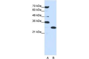 WB Suggested Anti-ANP32A Antibody Titration:  0. (PHAP1 Antikörper  (Middle Region))