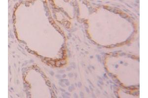 IHC-P analysis of Rat Ovary Tissue, with DAB staining. (Cytokeratin 7 Antikörper  (AA 255-393))
