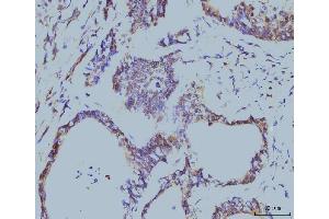 IHC analysis of Cyclophilin E/PPIE using anti-Cyclophilin E/PPIE antibody (ABIN7599243). (PPIE Antikörper  (AA 1-301))