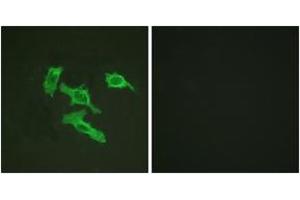 Immunofluorescence analysis of HepG2 cells, using EGFR (Ab-1016) Antibody. (EGFR Antikörper  (AA 986-1035))