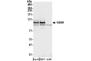 anti-Vasorin (Vasn) (AA 623-673) antibody