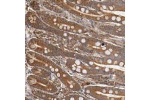 Immunohistochemical staining of human small intestine with VEZT polyclonal antibody  shows strong cytoplasmic positivity in glandular cells at 1:20-1:50 dilution.