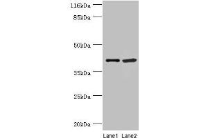 Western blot All lanes: NUDCD3 antibody at 5 μg/mL Lane 1: 293T whole cell lysate Lane 2: Hela whole cell lysate Secondary Goat polyclonal to rabbit IgG at 1/10000 dilution Predicted band size: 41 kDa Observed band size: 41 kDa (NUDCD3 Antikörper  (AA 142-361))