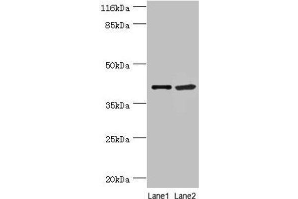 NUDCD3 antibody  (AA 142-361)
