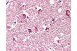 Anti-GPR119 antibody IHC of human brain, cortex. (G Protein-Coupled Receptor 119 Antikörper  (Cytoplasmic Domain))
